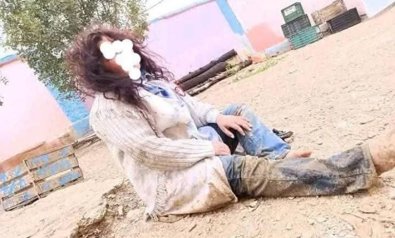 صادم.. اعتداء وحشي على أستاذة ووالدتها بجماعة سبت أيت باقليم خنيفرة