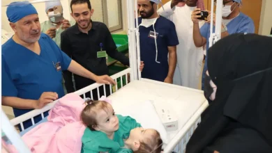 فريق طبي سعودي يبدأ فصل التوأم السوري سيلين وإيلين في عملية معقدة بالرياض